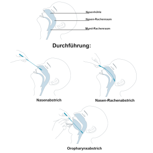 CLUNGENE Covid-19 Antigen Corona Rapid Test (Device-ID...