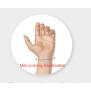 ThumbX bilateral tommelortose